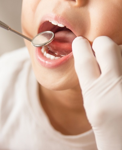 子どもの矯正歯科